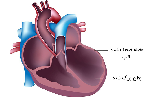 کاردیومیوپاتی