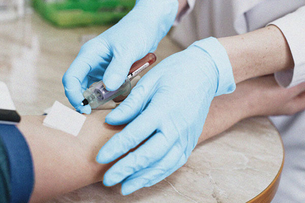 آزمایش Triglycerides چطور انجام می شود