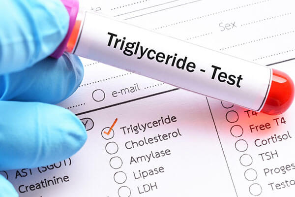 آزمایش Triglycerides چیست