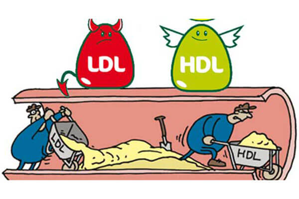 LDL کلسترول