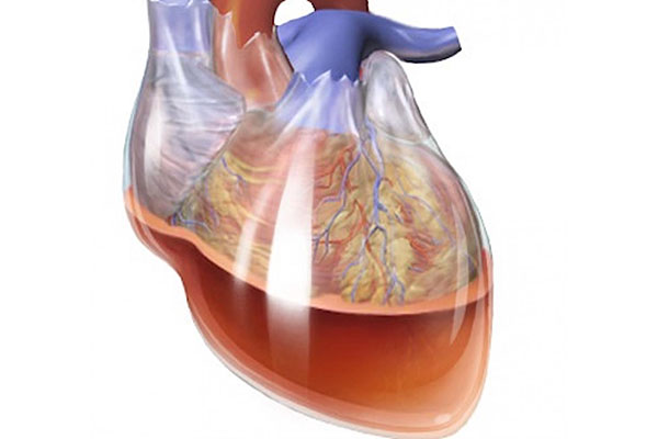 تامپوناد قلبی چیست