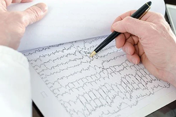 تشخیص ضربان قلب نامنظم